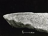 4 - Sezione longitudinale radiale del margine